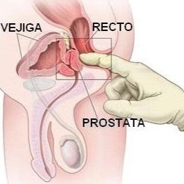 Gel para la Próstata